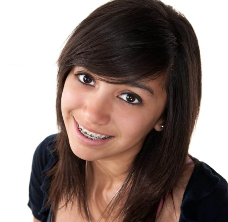why summer is a great time to start braces